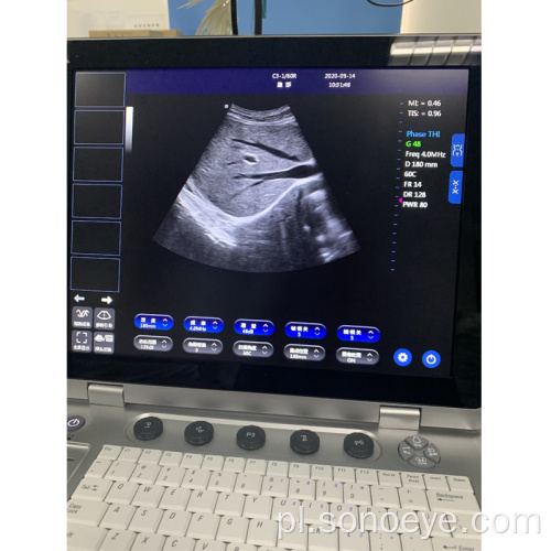 C5Pre Przenośny kolor laptopa Dopplera Ultrasound Machine